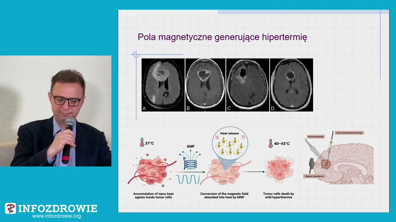 Postępy w onkologii w zakresie neurochirurgii