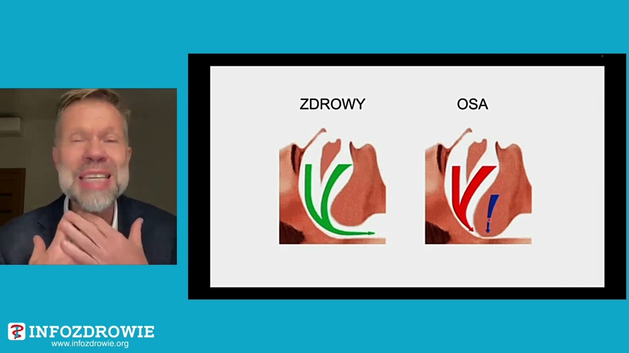 Powikłania choroby otyłościowej ze szczególnym uwzględnieniem niewydolności serca