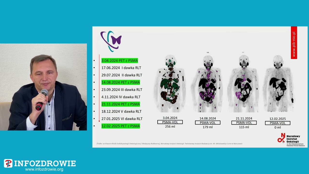 Terapia radioligandowa – nowa nadzieja !?!